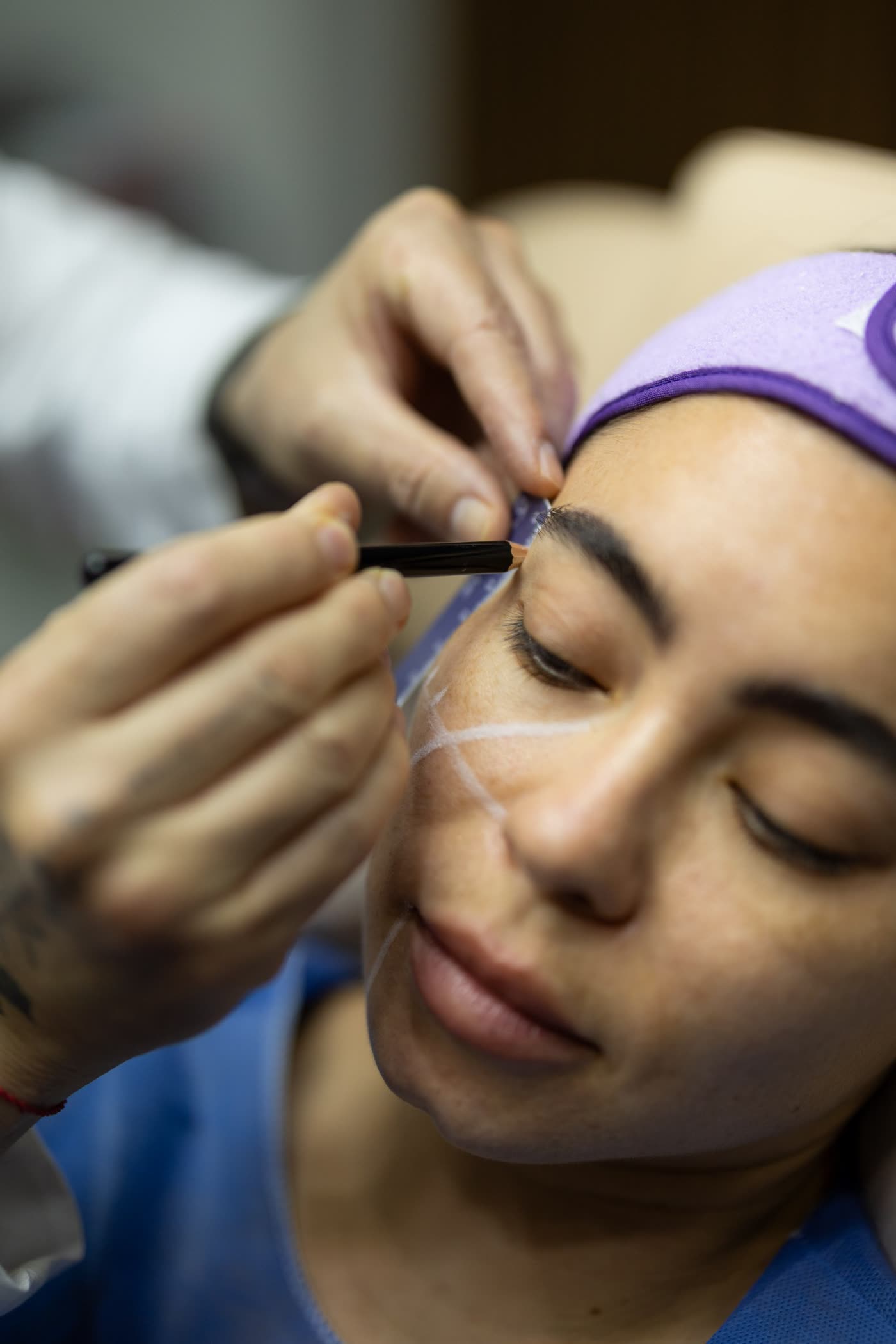 Facial assessment and marking before treatment